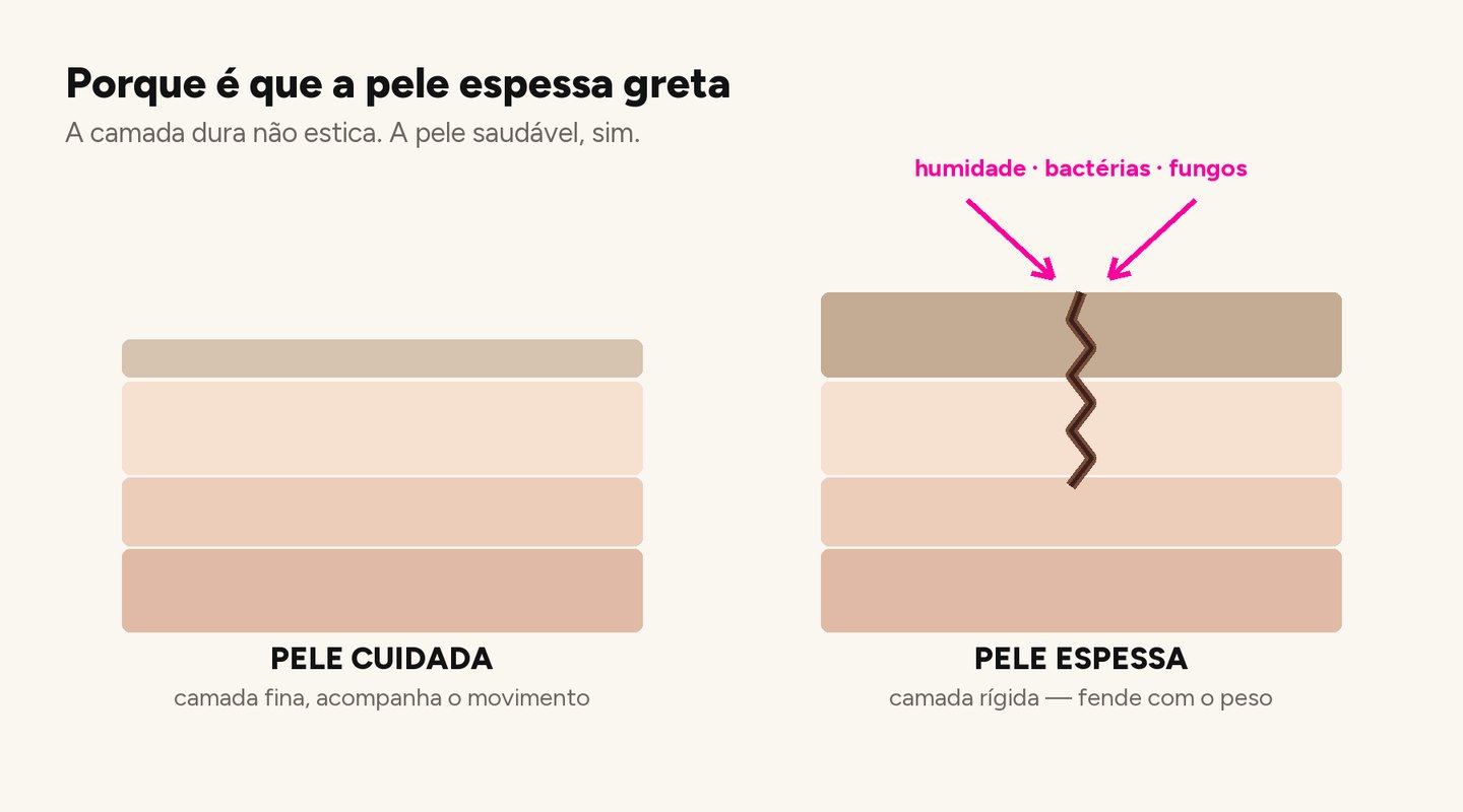 Diagrama: pele cuidada versus pele espessa que greta