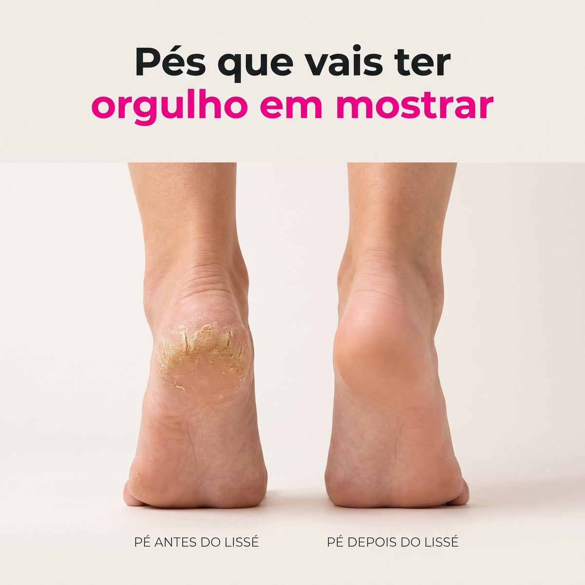 Lissé Pro 5